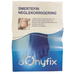 Onyfix Poster - Smertefri neglekorrigering A3